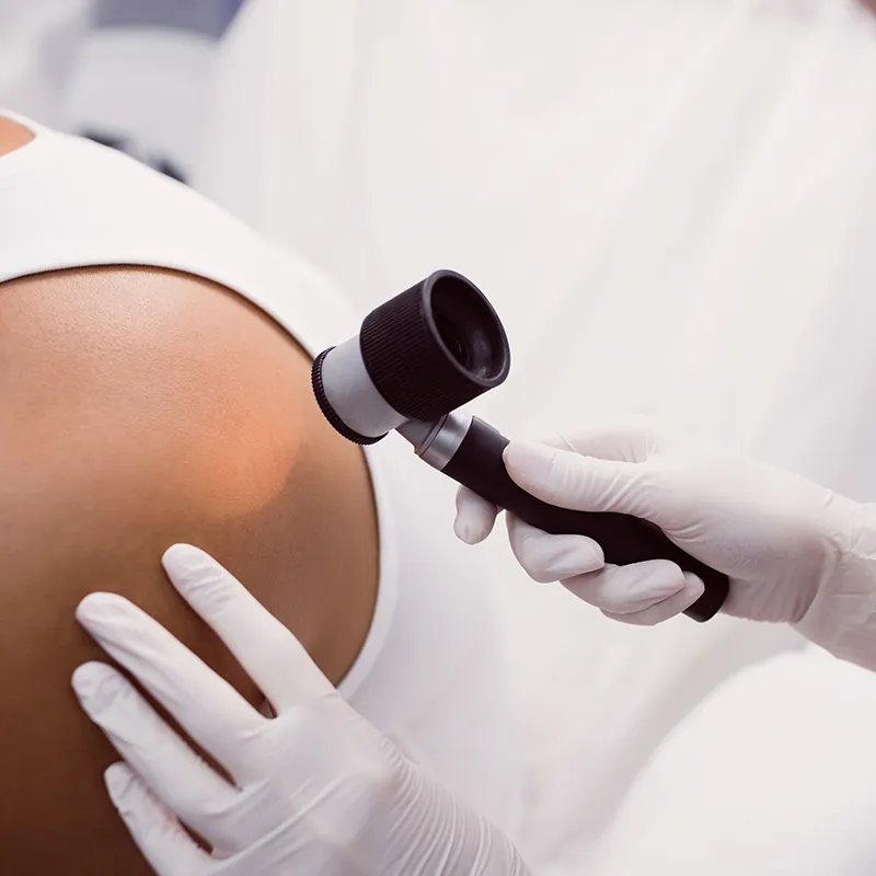 Centro medico specialistico spes napoli visita dermatologica senza prescrizione