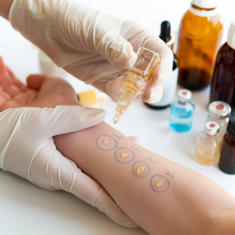 Centro medico specialistico spes napoli visita allergologica senza prescrizione