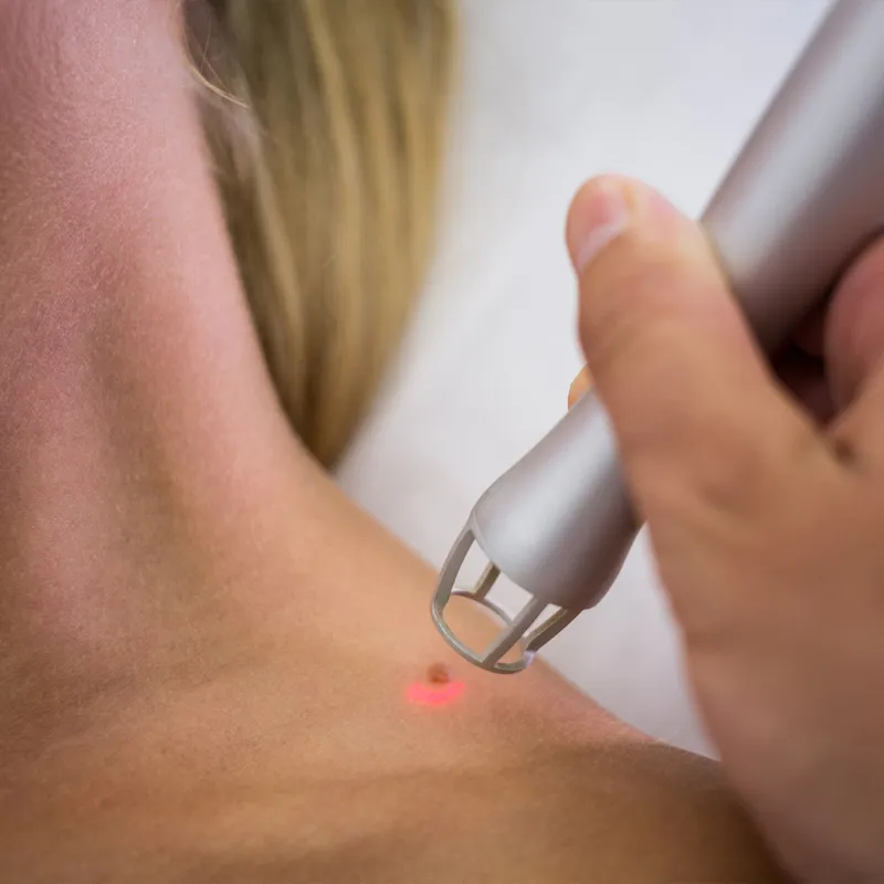 Centro medico specialistico spes napoli visita dermatologica senza prescrizione